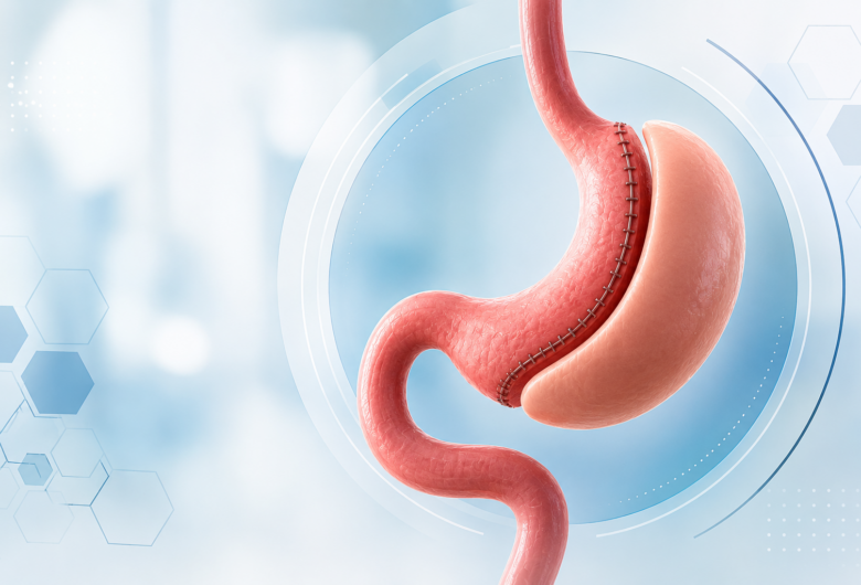 Gastroplastia: a transformação vai além da perda de peso